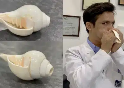 Muscheln blasen gegen Schlafapnoe